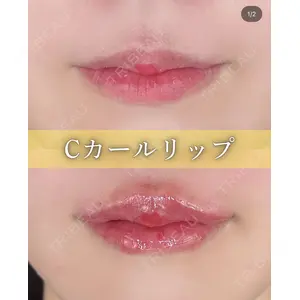 ルラ美容クリニック 京都院 矢田 玲奈医師の症例