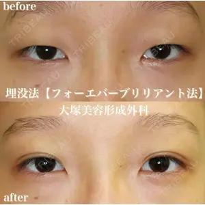 大塚美容形成外科 札幌院の症例