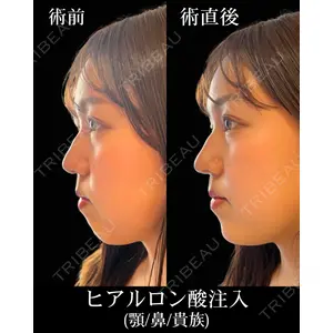 HAAB×DREAM BEAUTY CLINIC 東京本院 佐野 圭医師の症例
