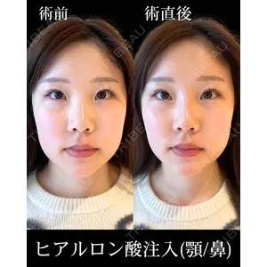 HAAB×DREAM BEAUTY CLINIC 東京本院 佐野 圭医師の症例