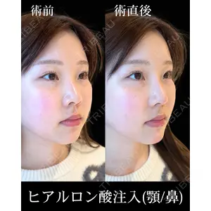 HAAB×DREAM BEAUTY CLINIC 東京本院 佐野 圭医師の症例