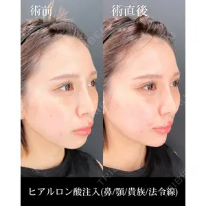 HAAB×DREAM BEAUTY CLINIC 大阪梅田院 錦 実奈医師の症例