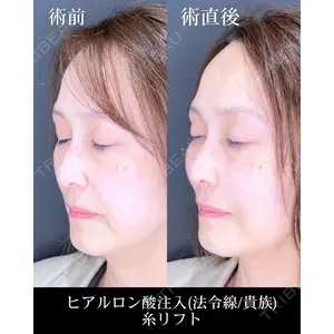 HAAB×DREAM BEAUTY CLINIC 大阪梅田院 錦 実奈医師の症例