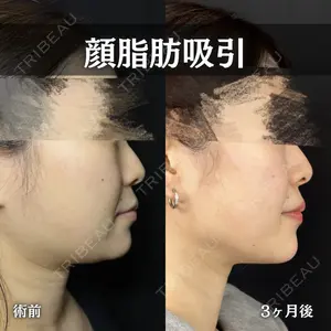 ルラ美容クリニック 新宿院 陶 美梨医師の症例