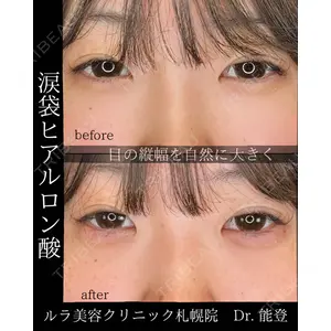 ルラ美容クリニック 札幌院の症例