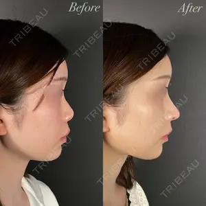 R Beauty CLINIC 大阪院 小池 泰弘医師の症例