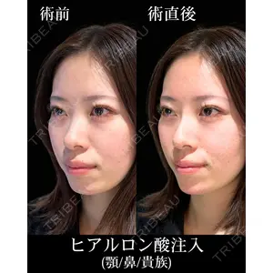 HAAB×DREAM BEAUTY CLINIC 東京本院 佐野 圭医師の症例