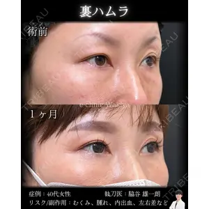 eクリニック 大阪院 脇谷 雄一朗医師の症例