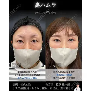 eクリニック 大阪院 脇谷 雄一朗医師の症例
