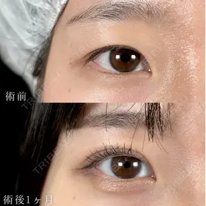 TCB東京中央美容外科 札幌大通院 森宮 佳輝医師の症例