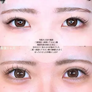 アリエル美容クリニック 大宮院 鈴木　桂介医師の症例