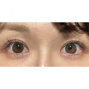 X CLINIC 銀座院 佐藤 由仁医師の症例