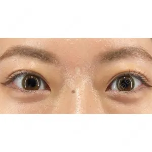 X CLINIC 銀座院 佐藤 由仁医師の症例