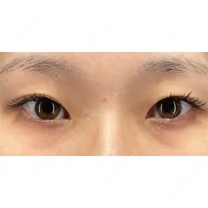 X CLINIC 銀座院 佐藤 由仁医師の症例