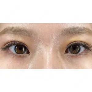 X CLINIC 銀座院 佐藤 由仁医師の症例
