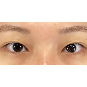 X CLINIC 銀座院 佐藤 由仁医師の症例