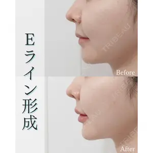 L‘amour clinic Tokyo【ラムールクリニック東京】の症例