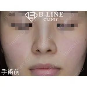 B-LINE CLINIC 池袋院 小池 康弘医師の症例