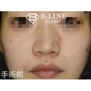 B-LINE CLINIC 池袋院 小池 康弘医師の症例