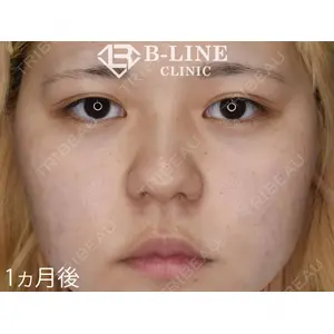 B-LINE CLINIC 池袋院 小池 康弘医師の症例