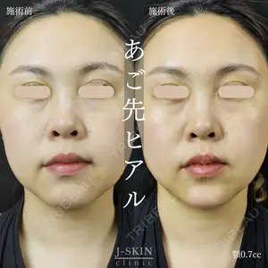Jスキンクリニック 【J-SKIN clinic】の症例