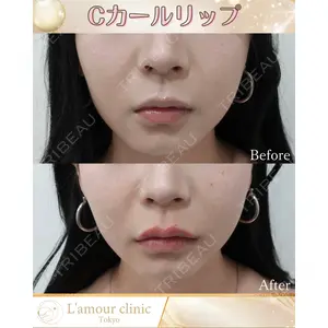 L‘amour clinic Tokyo【ラムールクリニック東京】の症例
