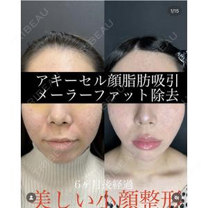 ルラ美容クリニック 渋谷本院 武内 大医師の症例