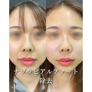 ルラ美容クリニック 渋谷本院 住友 沙織医師の症例