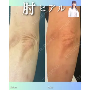 ルラ美容クリニック 渋谷本院 住友 沙織医師の症例