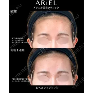 アリエル美容クリニック 横浜院 渡邉 光医師の症例