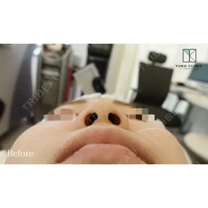 ユウコ形成外科クリニック 植田　有子医師の症例