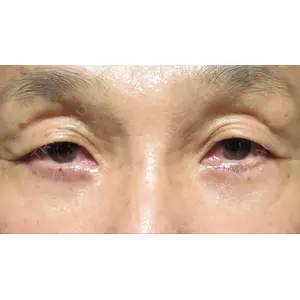 X CLINIC 恵比寿院 孫 駿一郎医師の症例