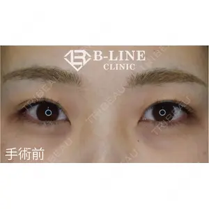 B-LINE CLINIC 池袋院 小池 康弘医師の症例