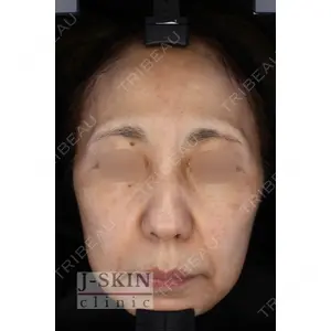 Jスキンクリニック 【J-SKIN clinic】 牧野　潤医師の症例