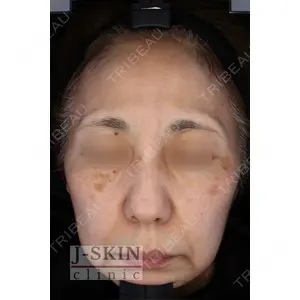 Jスキンクリニック 【J-SKIN clinic】 牧野　潤医師の症例