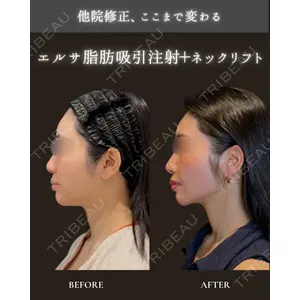 ICON CLINIC 小泉 彰郎医師の症例