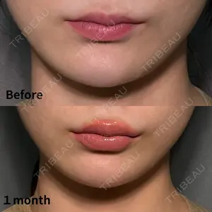 PRISM Beauty Clinic 町田院 森本 理一郎医師の症例