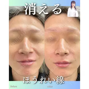 ルラ美容クリニック 渋谷本院 住友 沙織医師の症例