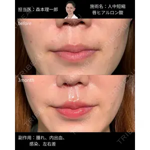 PRISM Beauty Clinic 町田院 森本 理一郎医師の症例