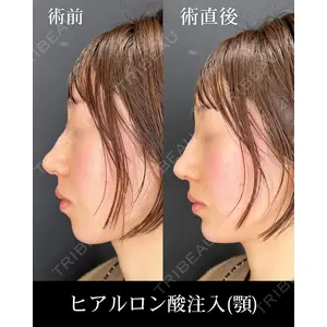 HAAB×DREAM BEAUTY CLINIC 大阪梅田院 柏木 太雅医師の症例