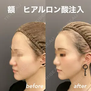 ロレシー美容クリニック 心斎橋駅前院 福留院長医師の症例