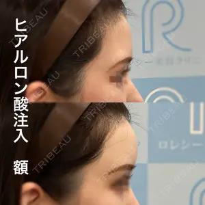 ロレシー美容クリニック 心斎橋駅前院 福留院長医師の症例