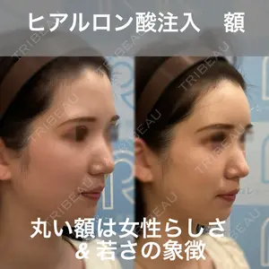 ロレシー美容クリニック 心斎橋駅前院 福留院長医師の症例