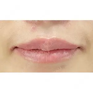 X CLINIC 銀座院 程 璐医師の症例