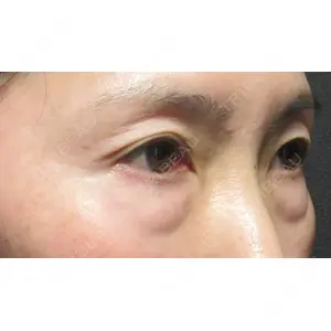 X CLINIC 恵比寿院 孫 駿一郎医師の症例