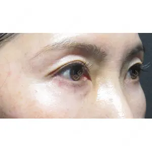 X CLINIC 恵比寿院 孫 駿一郎医師の症例