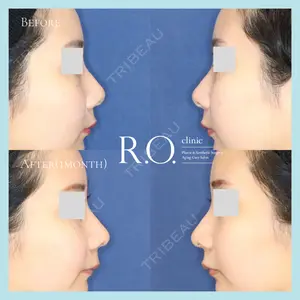 R.O.clinic 呂 秀彦医師の症例