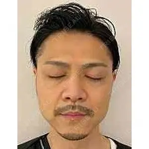 Rinato Beauty Clinic 関口 直樹医師の症例