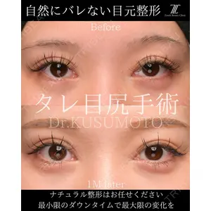 Zetith Beauty Clinic 大阪心斎橋院 楠本 拓哉医師の症例