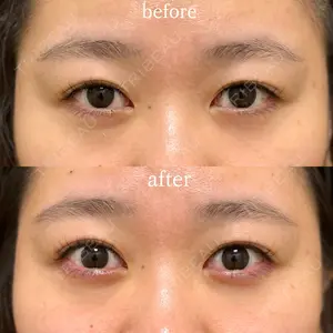 Wクリニック 福岡院 堂園 史子医師の症例